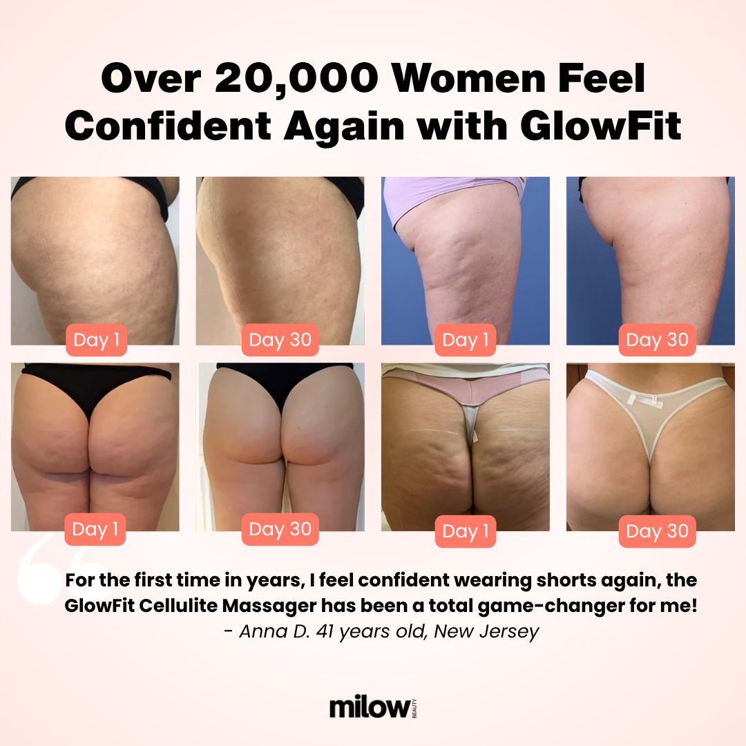 GlowFit™ 2.0 Cellulite Massager