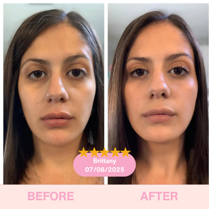 GlowLift Duo™ The Ultimate Lifting & Glow Routine