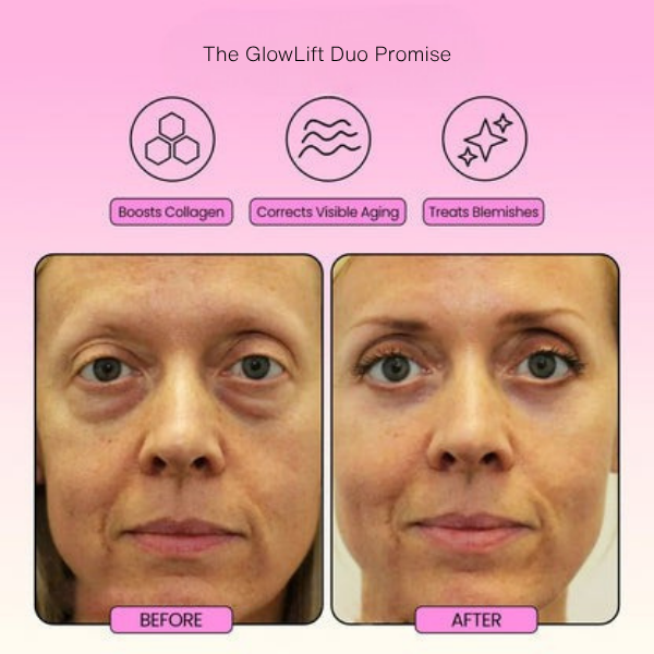 GlowLift Duo™ The Ultimate Lifting & Glow Routine