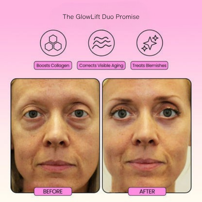 GlowLift Duo™ The Ultimate Lifting & Glow Routine