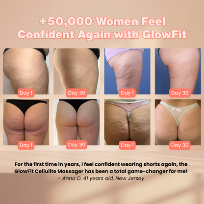 GLOWFIT™ CELLULITE MASSAGER - SUMMER SALE