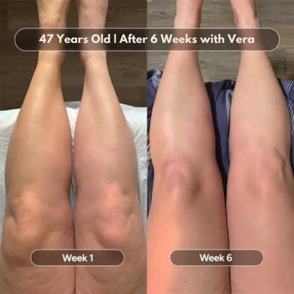 Free Milow Beauty™ Premium Anti-Cellulite Oil