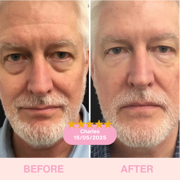 GlowLift Duo™ The Ultimate Lifting & Glow Routine