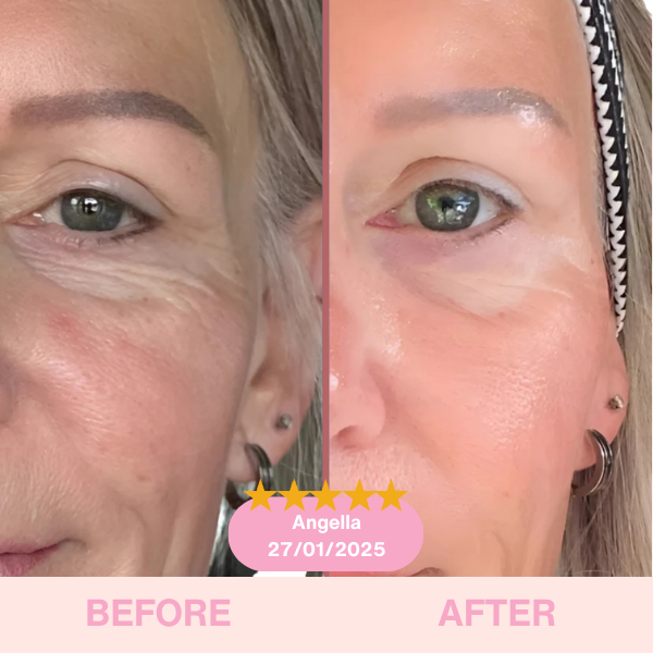 GlowLift Duo™ The Ultimate Lifting & Glow Routine