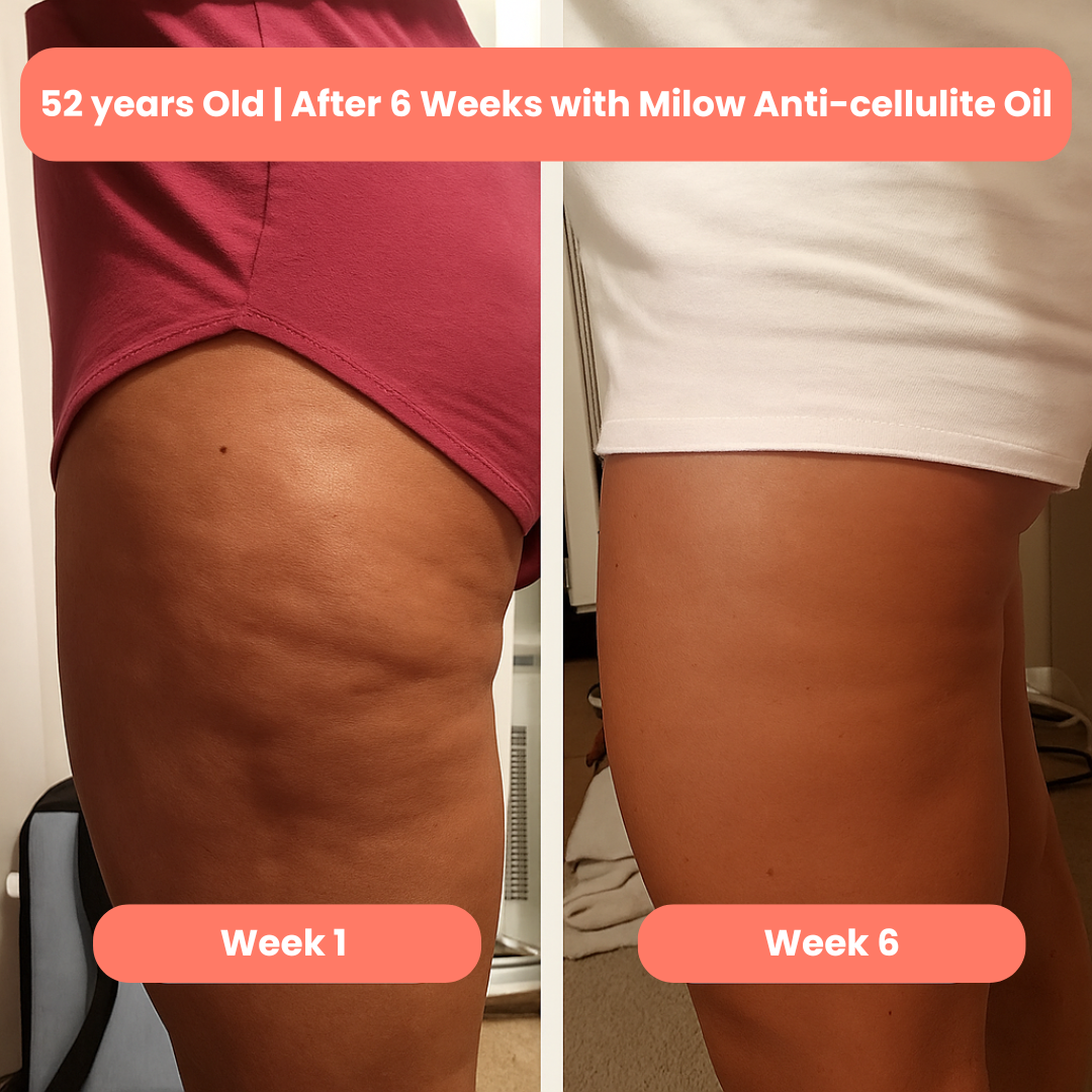 Milow Beauty™ Premium Anti-Cellulite Oil