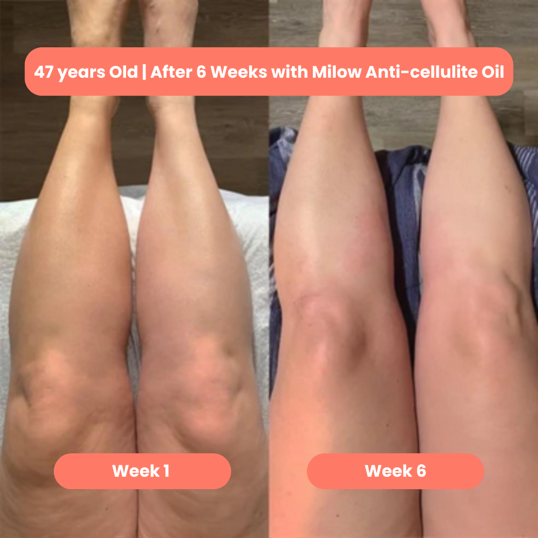 Milow Beauty™ Premium Anti-Cellulite Oil