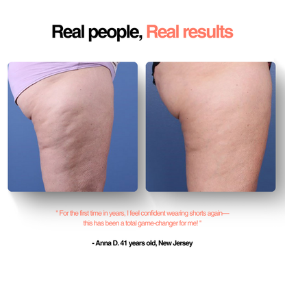 GlowFit™ Cellulite Massager