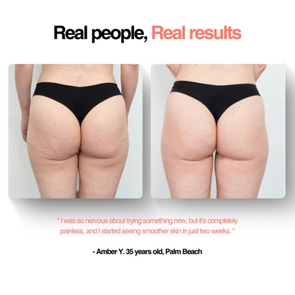 GlowFit™ Cellulite Massager