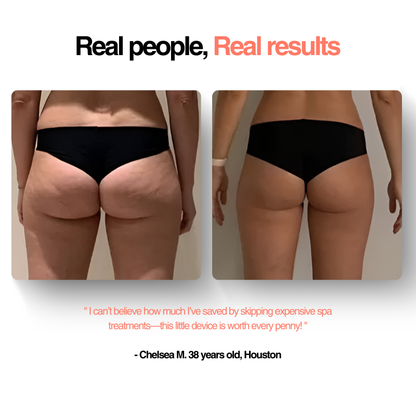 GlowFit™ Cellulite Massager