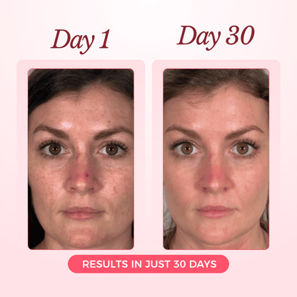 Advanced Collagen Sculpting Mask 2.0 (Spa-Level Results)