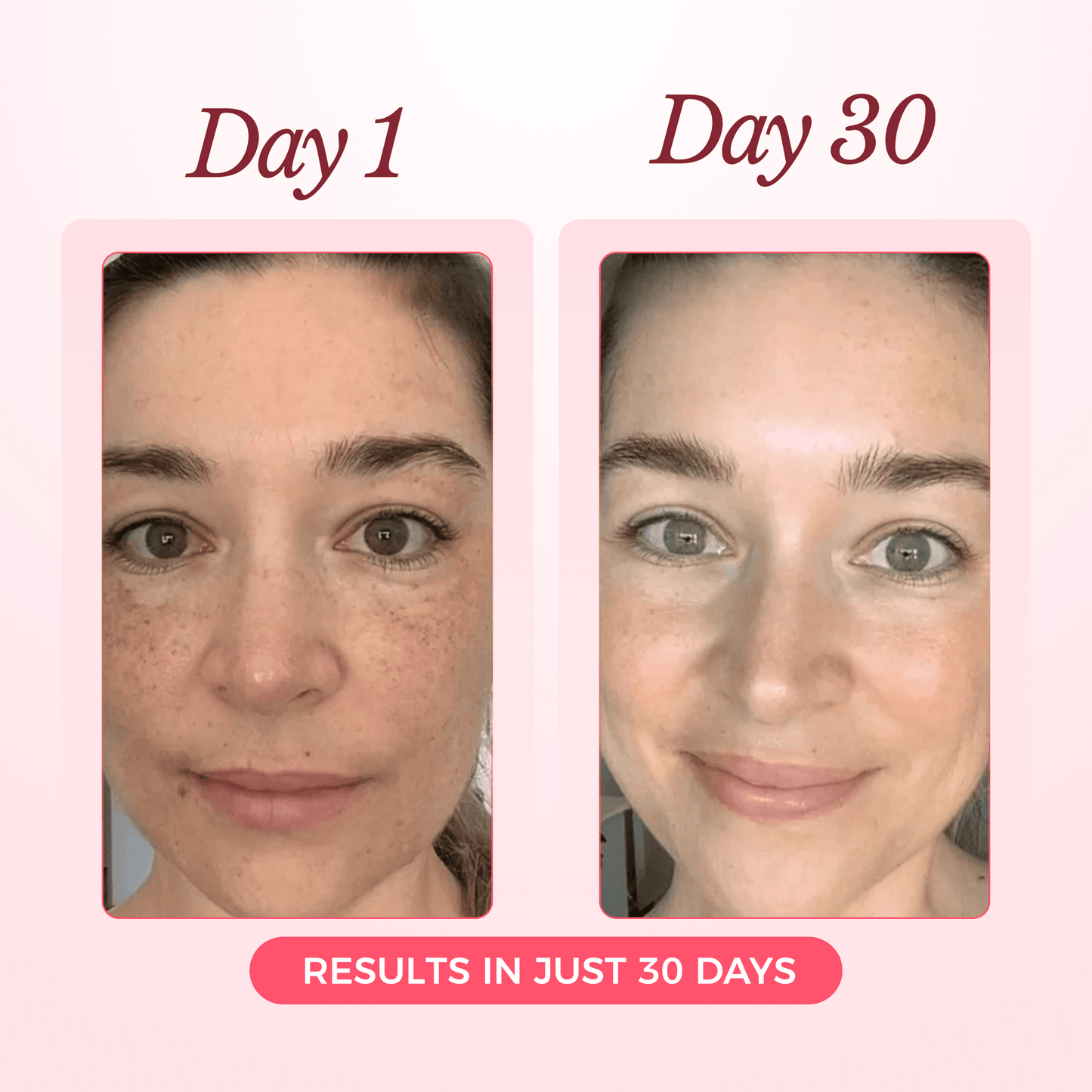 Advanced Collagen Sculpting Mask 2.0 (Spa-Level Results)