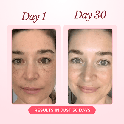 Advanced Collagen Sculpting Mask 2.0 (Spa-Level Results)