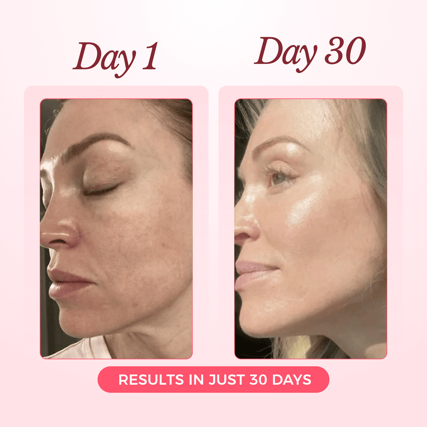 Advanced Collagen Sculpting Mask 2.0 (Spa-Level Results)