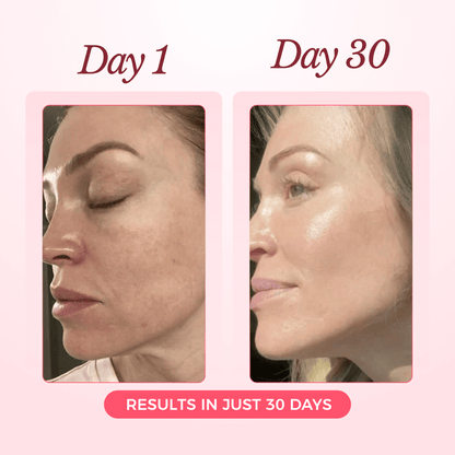 Advanced Collagen Sculpting Mask 2.0 (Spa-Level Results)